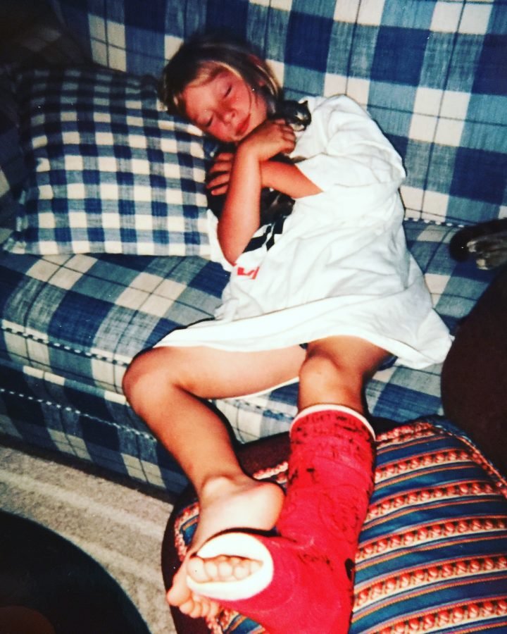 Nicole Ver Kuilen sitting on a couch with a cast on her left leg. She was diagnosed with osteosarcoma in her left tibia at age 10.
